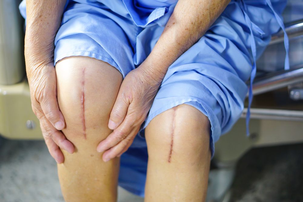 top 5 mistakes after knee replacement