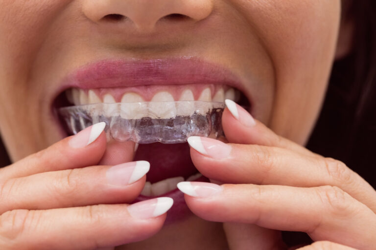 how to clean retainers